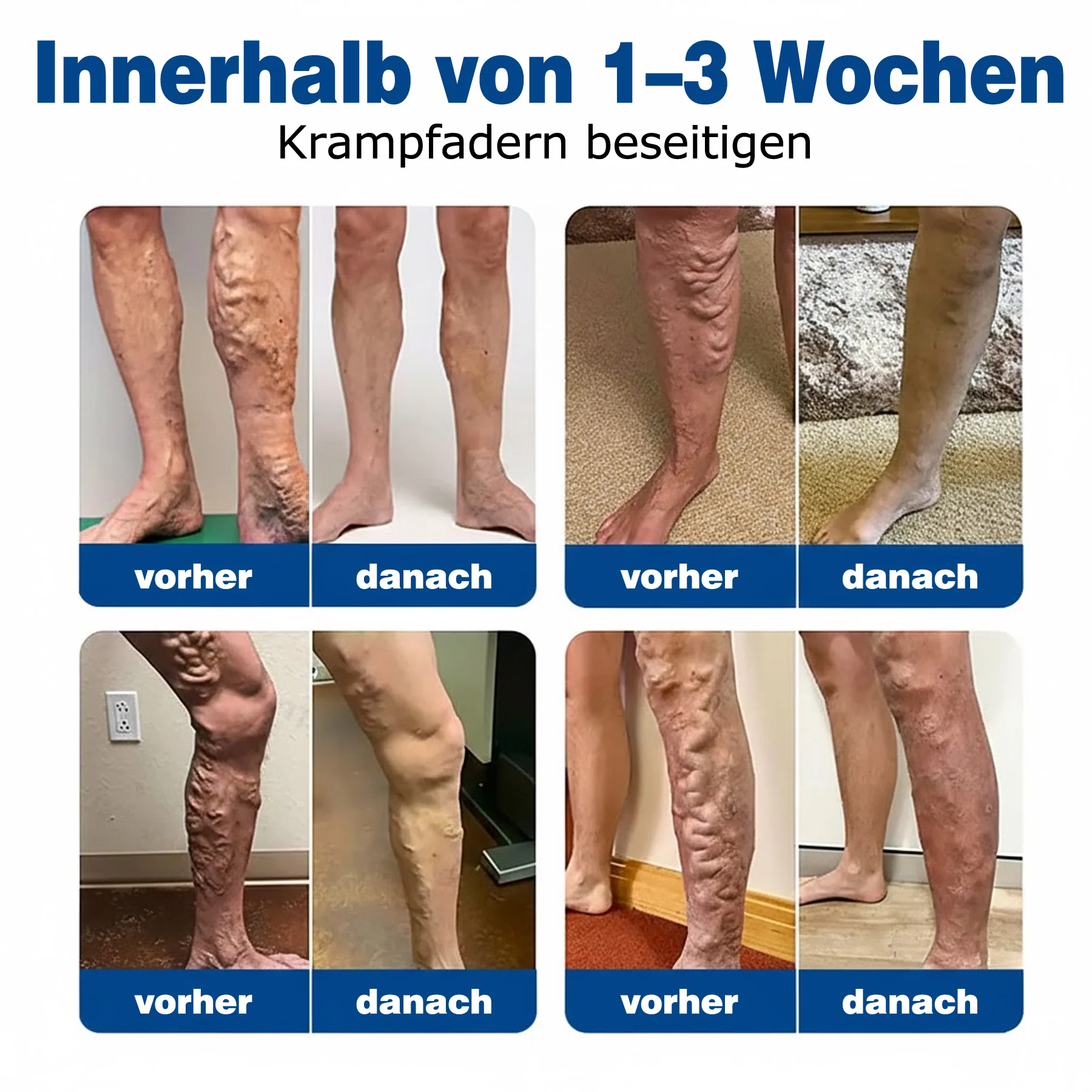🇩🇪👨‍⚕️💥 GFOUK® VeinTarget Mikronadel-Pflaster ⚡ Sofortige Linderung, Langfristige Ergebnisse - Image 3