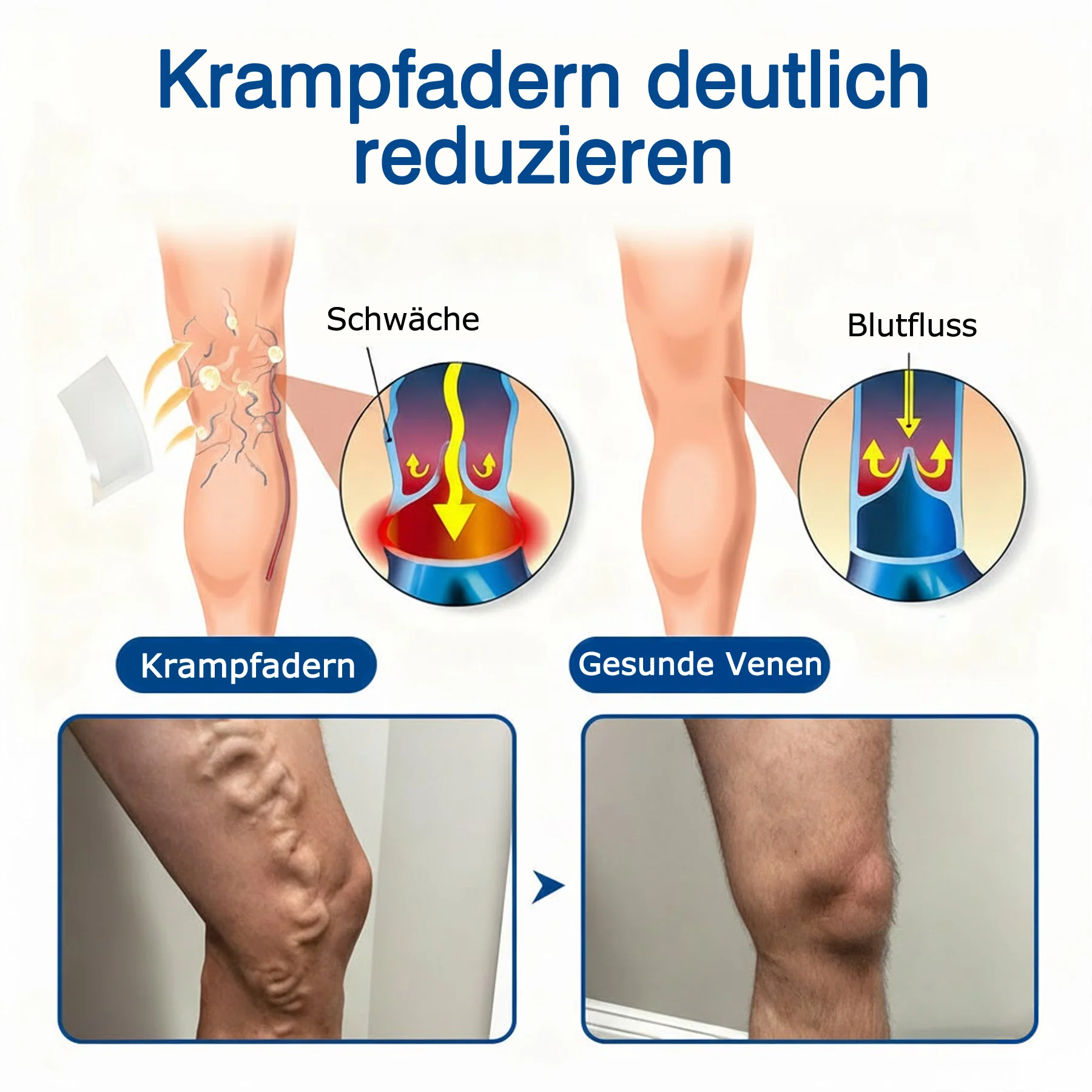 🇩🇪👨‍⚕️💥 GFOUK® VeinTarget Mikronadel-Pflaster ⚡ Sofortige Linderung, Langfristige Ergebnisse - Image 4