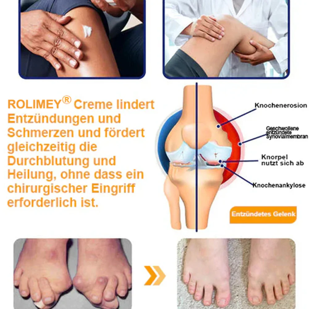 ✅ Offizieller Shop: Rolimey® Bienengift-Schmerzlinderungs Knochenheilungs Creme 👨‍⚕️(Reduzierung von Gelenkschwellungen, Schmerzen, Steifheit, Rötungen, Wärme, Muskelkater und Gelenkmüdigkeit) - Image 11