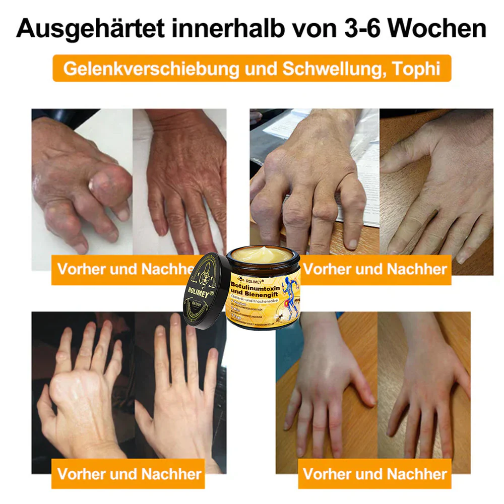 ✅ Offizieller Shop: Rolimey® Bienengift-Schmerzlinderungs Knochenheilungs Creme 👨‍⚕️(Reduzierung von Gelenkschwellungen, Schmerzen, Steifheit, Rötungen, Wärme, Muskelkater und Gelenkmüdigkeit) - Image 3