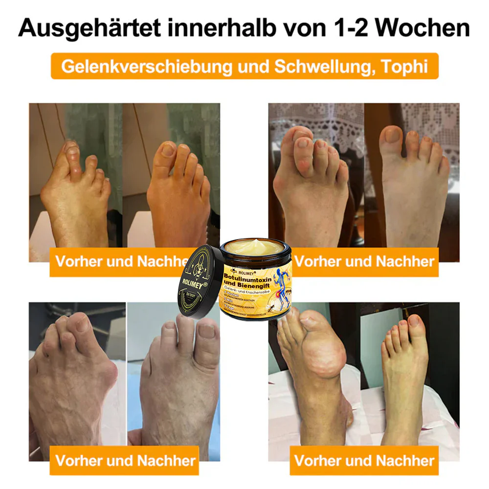 ✅ Offizieller Shop: Rolimey® Bienengift-Schmerzlinderungs Knochenheilungs Creme 👨‍⚕️(Reduzierung von Gelenkschwellungen, Schmerzen, Steifheit, Rötungen, Wärme, Muskelkater und Gelenkmüdigkeit) - Image 6